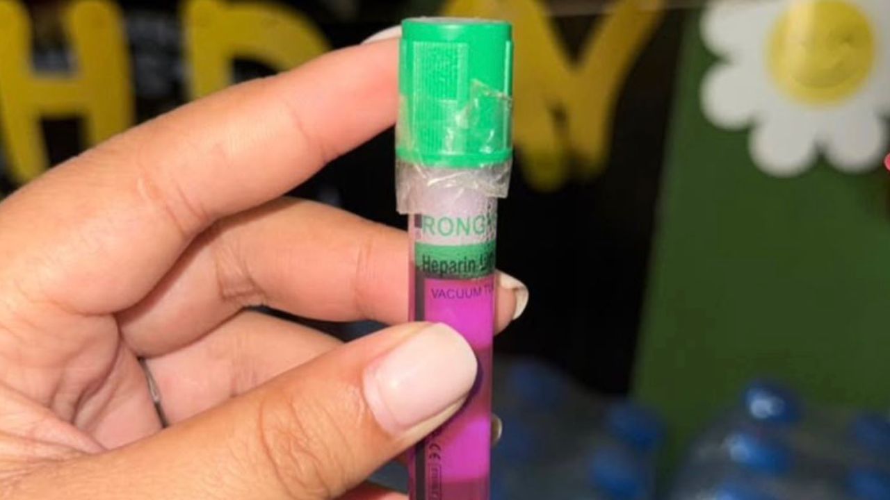 อันตรายมาก 'หมอแล็บ' เตือนภัย 'หลอดเก็บตัวอย่างเลือด' ถูกนำมาทำเป็นของเล่นเด็ก