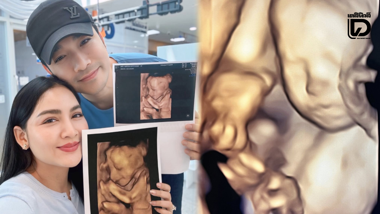 'เจมส์ เรืองศักดิ์' อวดภาพอัลตราซาวด์ลูกสาวคนที่ 2