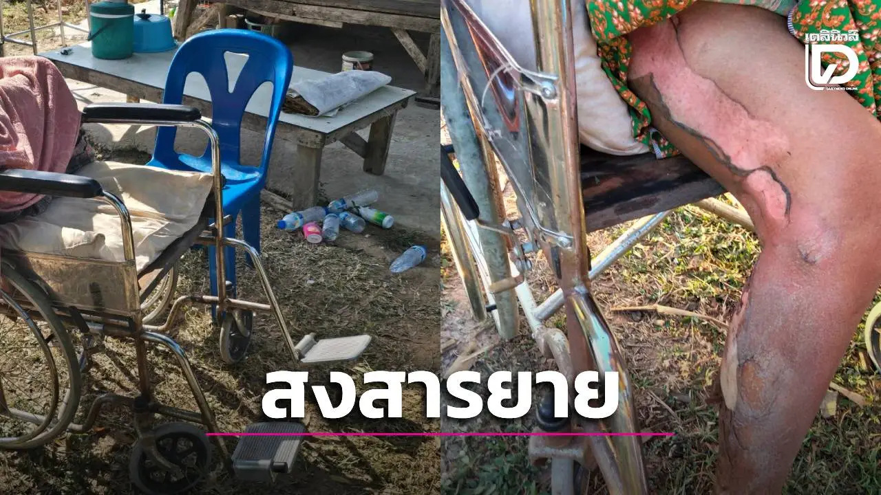 'เพราะคำว่าหิว!' ยาย 81 วูบตกกองไฟไหม้ทั่วร่าง ลูกชายป่วยติดเตียงช่วยไม่ได้ ได้แต่เคาะฝาบ้านเรียกคนช่วย