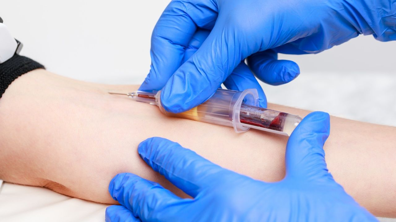 'สภาเทคนิคการแพทย์' ชี้แจงประเด็น 'งดน้ำ-งดอาหาร' ก่อนการเจาะเลือด