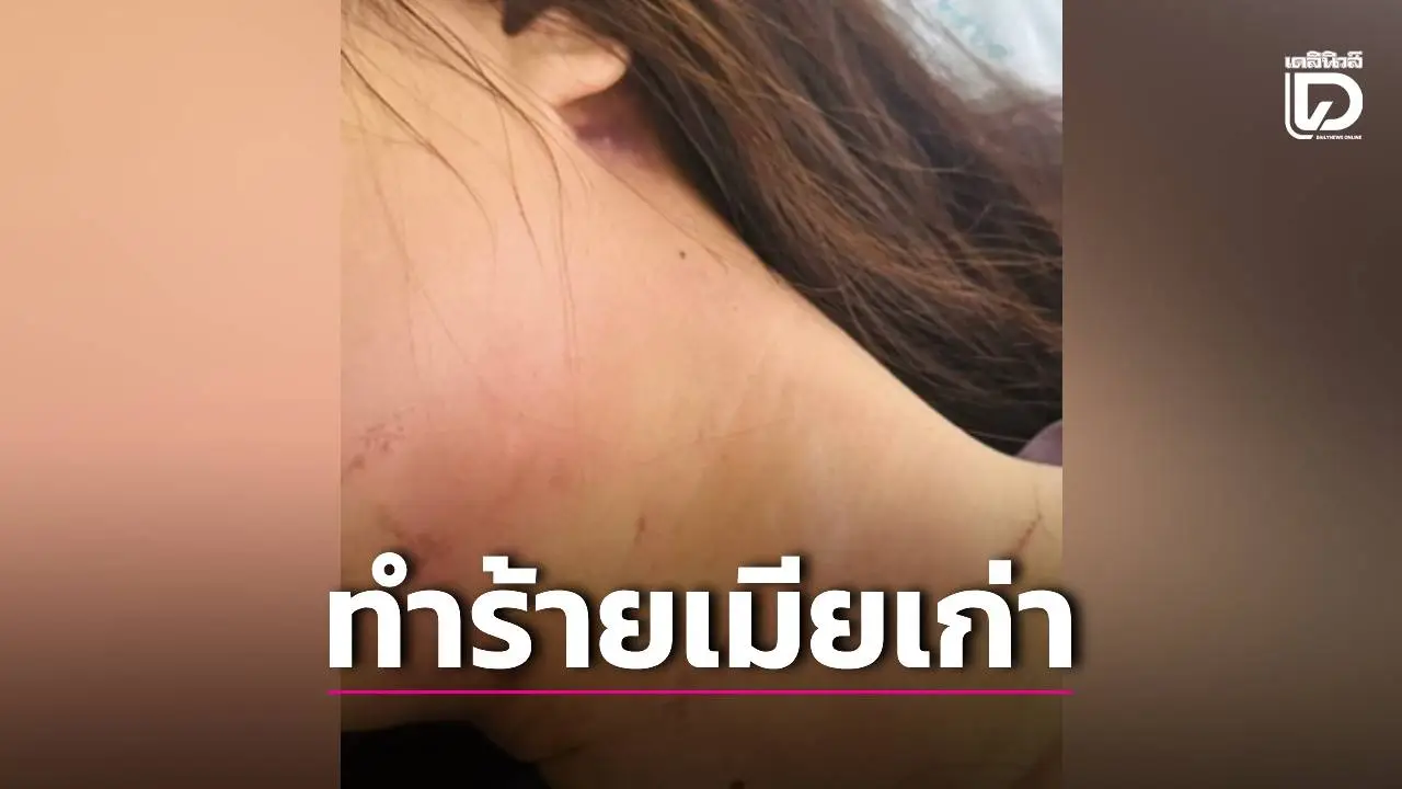อดีตผัวเห็นภาพบาดใจบินลัดฟ้า บุกทำร้ายเมียเก่าเลือดคั่ง-ซี่โครงหัก