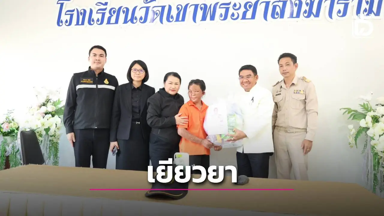 ‘อัครนันท์’ ห่วงใยไม่ห่าง สั่ง สพฐ. ติดตามเยียวยานักเรียนเหตุเพลิงไหม้รถบัสทัศนศึกษา ส่งกำลังใจต่อเนื่อง
