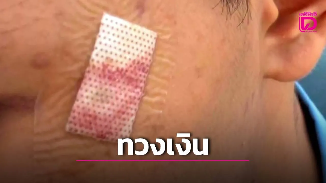 ขอนแก่นวิทยายน แจงปม ม.6 ถูกเพื่อนแกล้ง-บุหรี่จี้ ชี้เหตุทวงเงิน เคารพสิทธิหากแจ้งความ